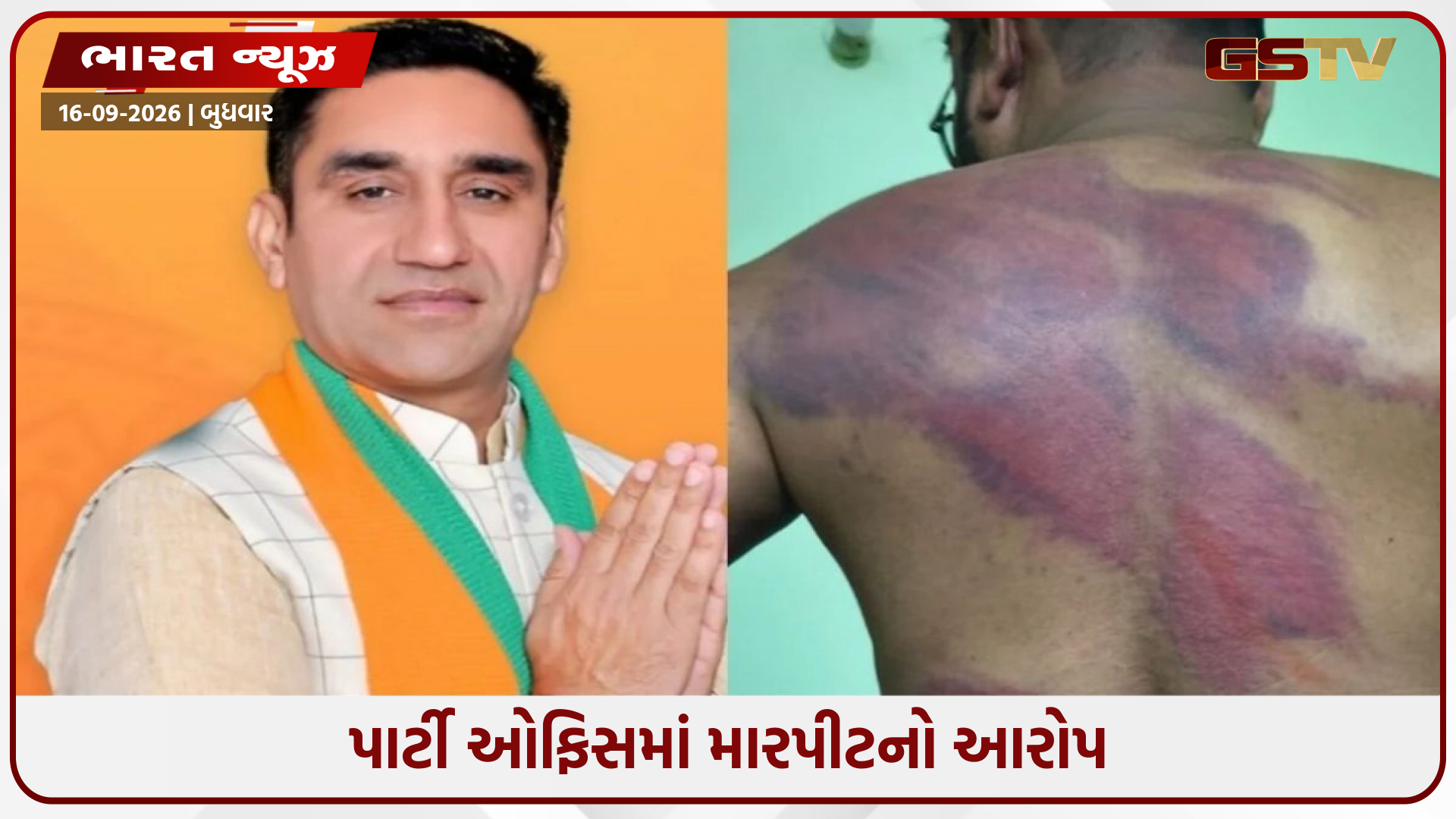 દિલ્હી ભાજપના ધારાસભ્ય સામે એસસી-એસટી એક્ટ હેઠળ કેસ, મારપીટનો આરોપ