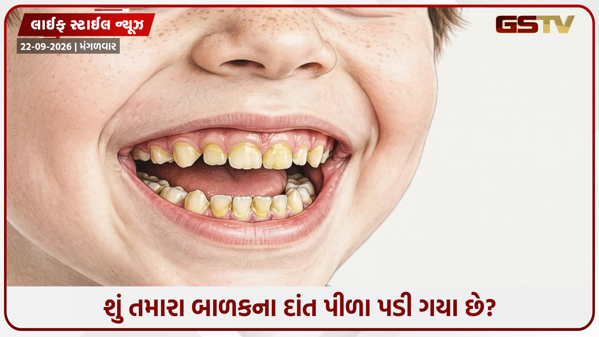 બાળકના પીળા પડેલા દાંત મિનિટોમાં ચમકશે! બ્રશ પર લગાવો આ 2 દેશી વસ્તુઓ