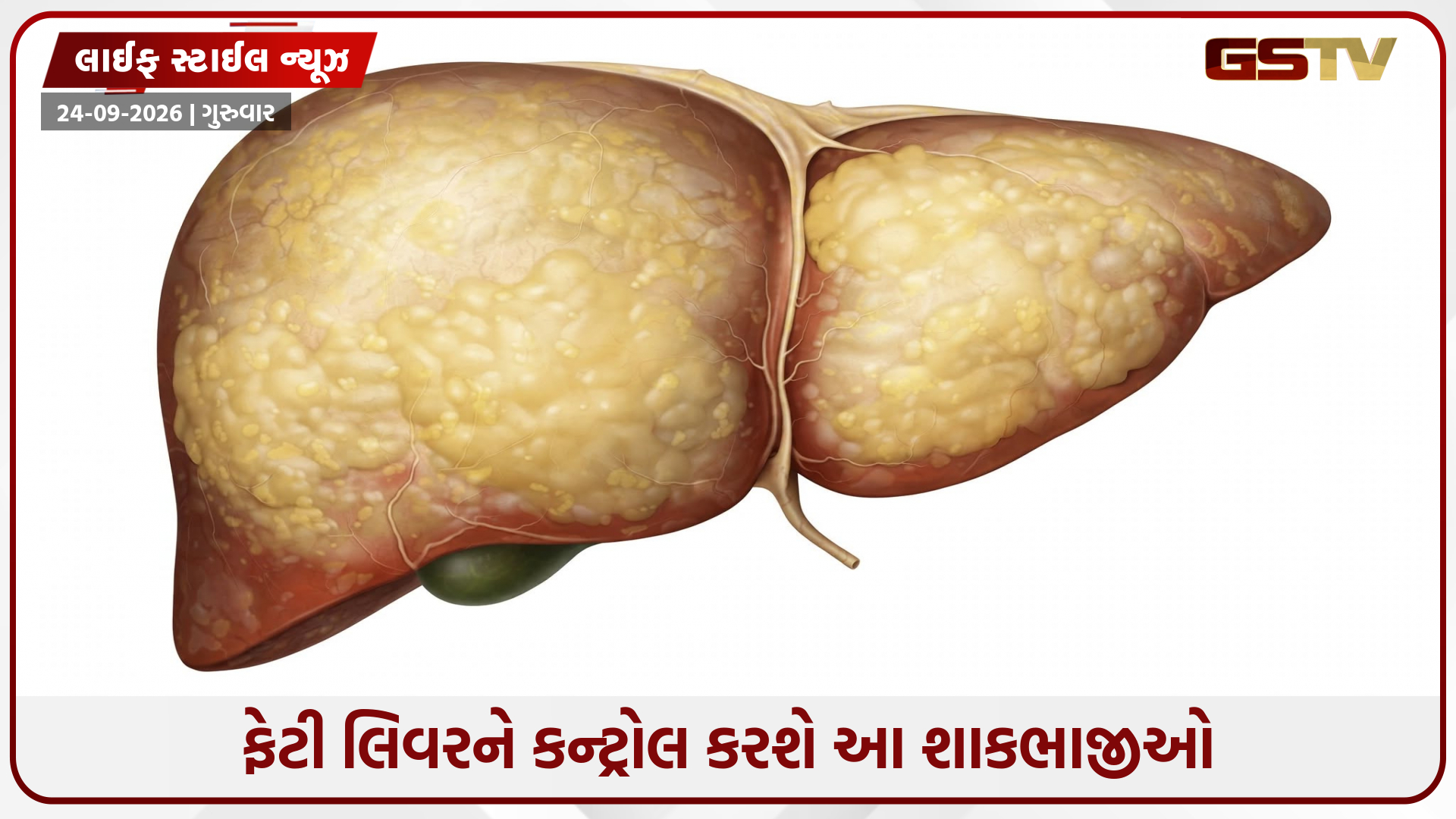 ફેટી લિવર માટે સંજીવની સમાન છે આ 4 શાકભાજી, ડાયટમાં જરૂર કરો સામેલ