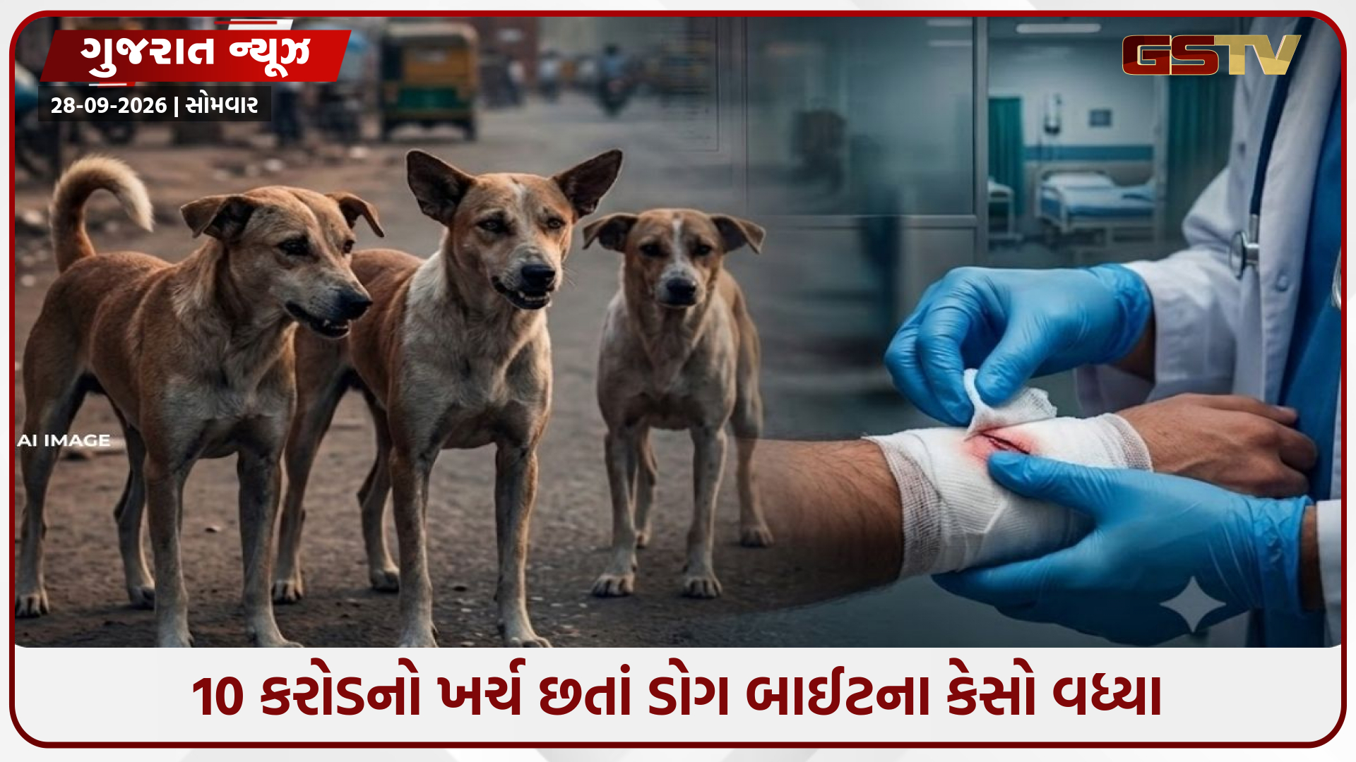 10 કરોડ ખર્ચ્યા છતાં શ્વાનના કરડવાના કેસો વધ્યા! અમદાવાદમાં રોજ 211 કેસ, એક વર્ષમાં 29%નો ઉછાળો