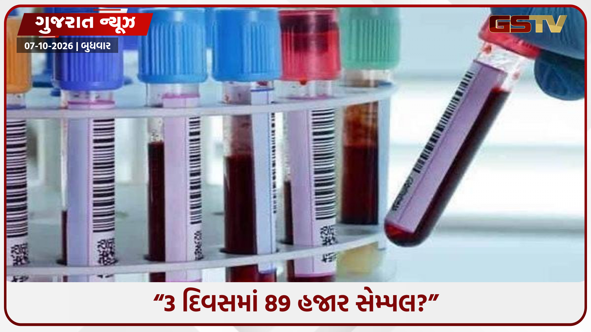 3 દિવસમાં 89 હજાર સેમ્પલ! ડેન્ગ્યુ-મલેરિયા વચ્ચે AMCના ‘સેમ્પલની સંખ્યાએ ચોંકાવ્યા